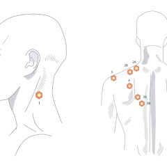 Illustration zeigt Punkte am Nacken und Rücken, die auf trapezmuskel schmerzen hinweisen.