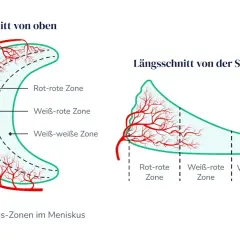 Darstellung der Durchblutungszonen im Meniskus. Wichtig für die Heilung bei Meniskusriss Symptome Test.