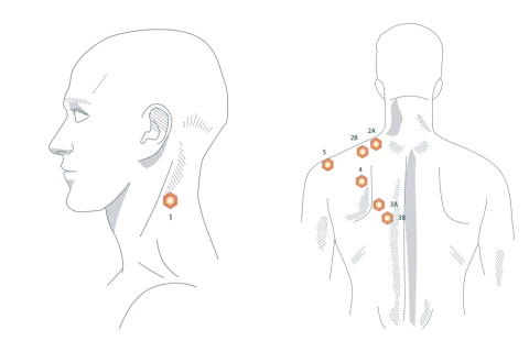 Illustration zeigt Punkte am Nacken und Rücken, die auf trapezmuskel schmerzen hinweisen.