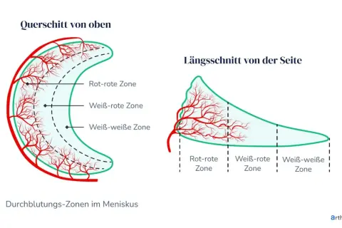 Darstellung der Durchblutungszonen im Meniskus. Wichtig für die Heilung bei Meniskusriss Symptome Test.
