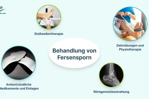 Behandlung von Fersensporn: Stoßwellentherapie, Dehnübungen, Medikamente, Einlagen und Röntgenreizbestrahlung helfen.