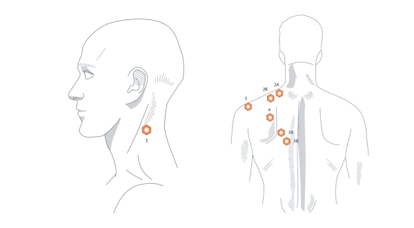 Illustration zeigt Punkte am Nacken und Rücken, die auf trapezmuskel schmerzen hinweisen.