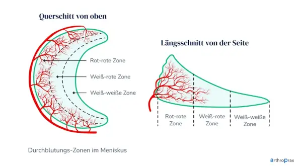 Darstellung der Durchblutungszonen im Meniskus. Wichtig für die Heilung bei Meniskusriss Symptome Test.