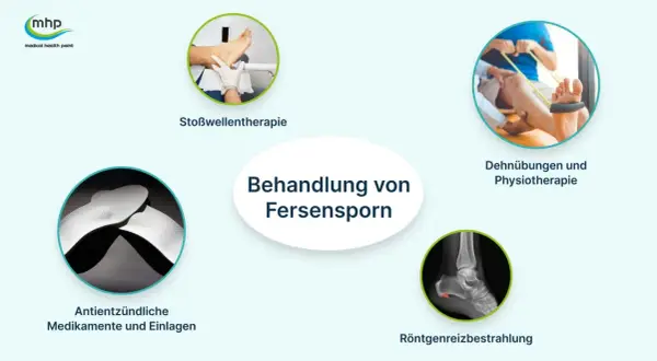 Behandlung von Fersensporn: Stoßwellentherapie, Dehnübungen, Medikamente, Einlagen und Röntgenreizbestrahlung helfen.