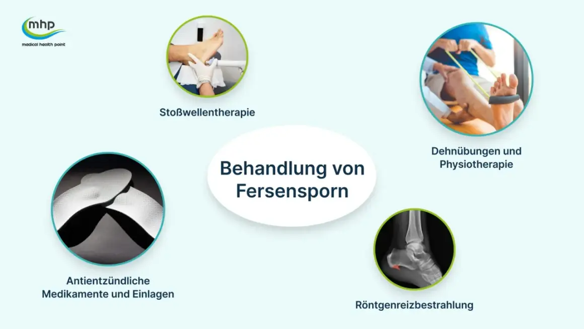 Behandlung von Fersensporn: Stoßwellentherapie, Dehnübungen, Medikamente, Einlagen und Röntgenreizbestrahlung helfen.
