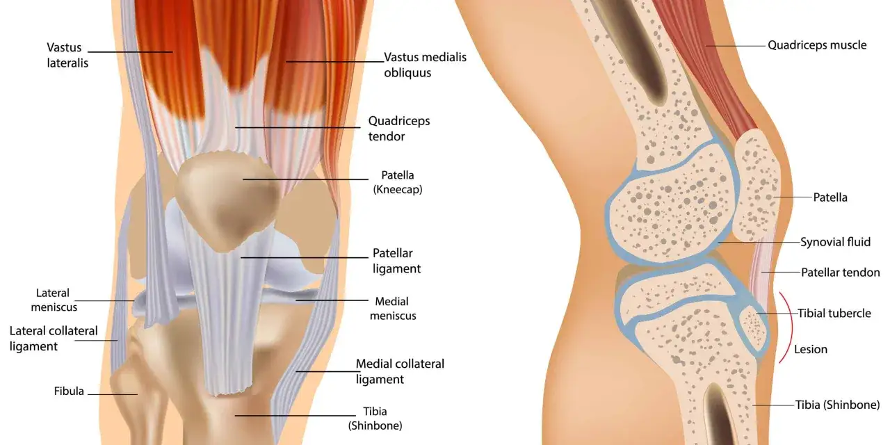 Anatomie des Knies mit Muskeln, B&auml;ndern und Knochen. M&ouml;gliche verklebte Faszien am Knie k&ouml;nnen Symptome wie Schmerzen verursachen.