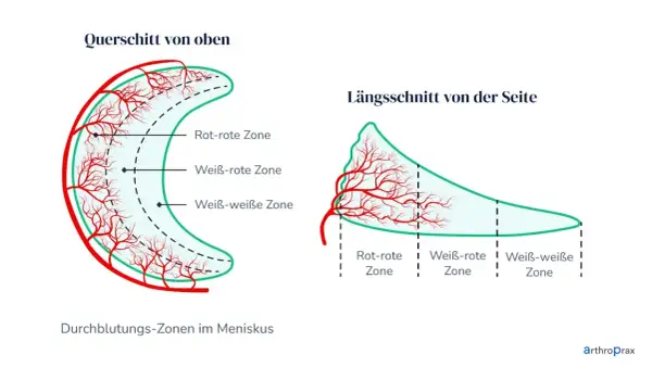 Darstellung der Durchblutungszonen im Meniskus. Wichtig für die Heilung bei Meniskusriss Symptome Test.